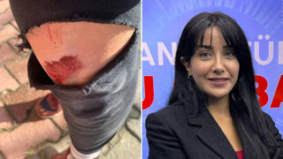 Kadın gazeteciye öldüresiye saldırı: ''Yoldan geçenler kurtardı, yoksa öldüreceklerdi''