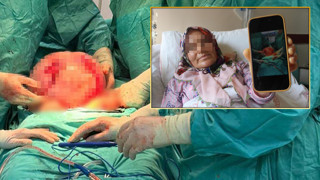 Bir anda karnı şişmeye başlayan kadının karnından çıkarılan kitle doktorları da şoke etti!