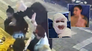 Genç kadın başka bir kadın tarafından sokak ortasında ateşe verildi!