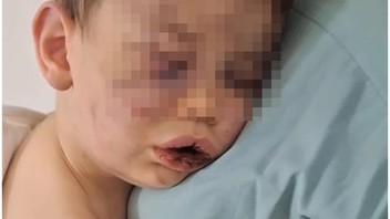Annesinin sevgilisi dehşeti yaşattı: 2 yaşındaki bebek hastanelik oldu!