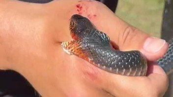 Bir vatandaş eline alıp ''zararsızdır öldürmeyin'' dediği yılan tarafından ısırıldı!