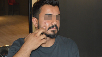 Bir güzellik merkezi skandalı daha; bu sefer ki mağdur bir erkek!