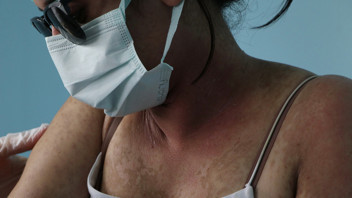 Sosyal medya reklamına kandı, 4 gün yoğun bakımda ölüm kalım savaşı verdi!