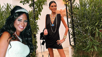 Sosyetenin güzel ismi son haliyle korkuttu: ''Günde 1 öğün besleniyorum''