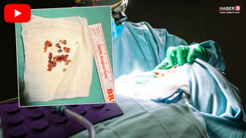 Estetik ameliyatı sırasında hastanın burnundan çıkanlar şoke etti