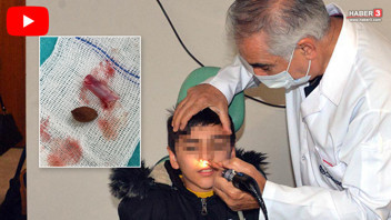 Kaşıntısı olan küçük çocuğun burnundan çıkanlar şaşkına çevirdi