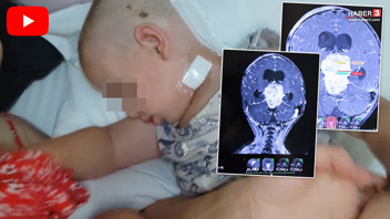 Davranışlarındaki değişim tedirgin etmişti... Minik çocuğun beyninden çıkan şey şoke etti!