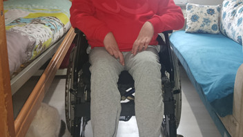 Onu herkes ''Stikman'' adıyla tanınıyor... Tedavisi için Elon Musk'tan yardım istedi