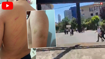 İstanbul'da ortaokulda skandal iddia: Öğretmen dayağı bu hale getirdi!