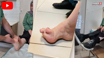 Çocukken akranları alay etmişti.... Tam 51 yaşında ilk kez ayakkabı giyebildi