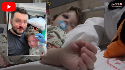 Babayı 14 aylık bebeğiyle birlikte darbettiler! Minik bebeğin kafatası çatladı!