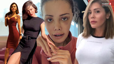 Oryantal Star ve Survivor'ın yüz nakli olan güzelinden kötü haber geldi