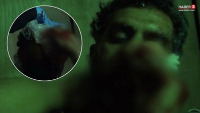 Survivor'da apar topar hastaneye kaldırılan Bayhan'dan korkutan haber!