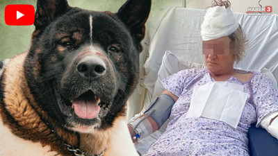 Patronunun köpeği parçaladı, ölümden döndü...  Kadın korumanın 80 dikişli yaşam mücadelesi sürüyor