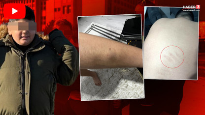 Ankara'da okulda kan donduran iddia: Otizmli öğrenciye şiddete müdür kalkanı!