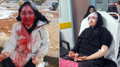 Genç kadına kaldırım taşıyla öldüresiye dayak! Tanınmaz hale geldi