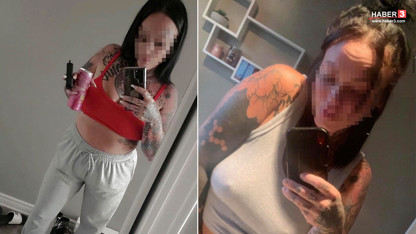 Kanada'dan Türkiye'ye geldi, estetik ameliyat faciayla bitti!