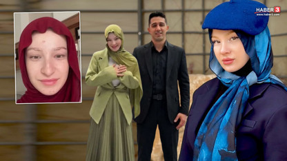 Sosyal medyanın tesettürlü fenomeninin estetiksiz hali tartışma başlattı