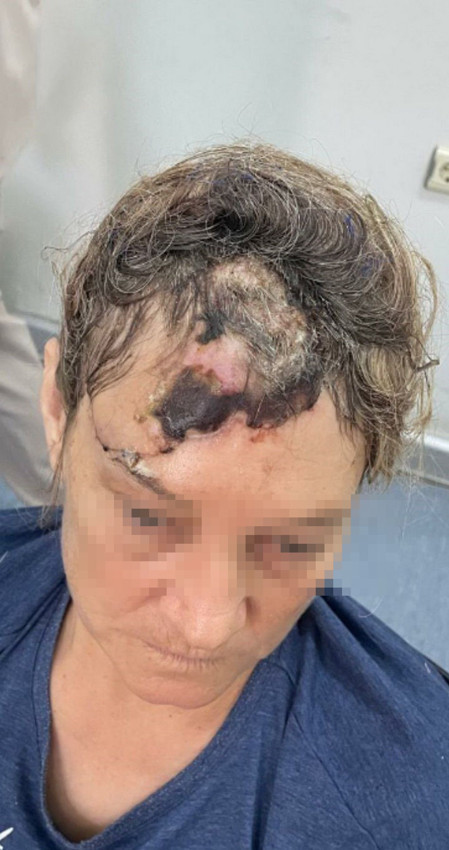 Patronunun köpeği parçaladı, ölümden döndü...  Kadın korumanın 80 dikişli yaşam mücadelesi sürüyor - Resim: 3