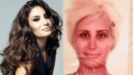 Ünlülerin estetiksiz hali - Resim: 2