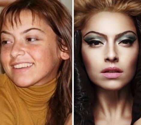 Ünlülerin estetiksiz hali - Resim: 1