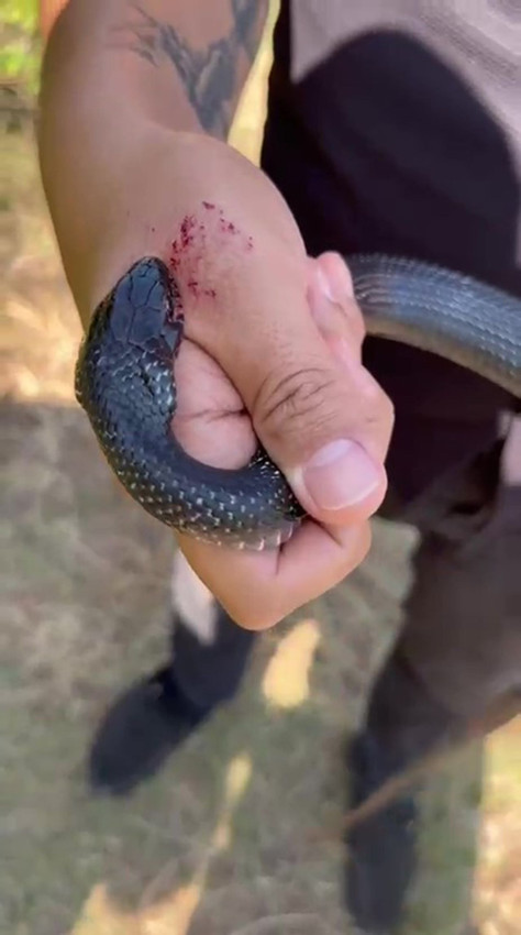Bir vatandaş eline alıp ''zararsızdır öldürmeyin'' dediği yılan tarafından ısırıldı - Resim: 1
