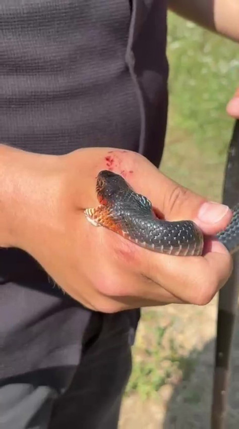 Bir vatandaş eline alıp ''zararsızdır öldürmeyin'' dediği yılan tarafından ısırıldı - Resim: 2