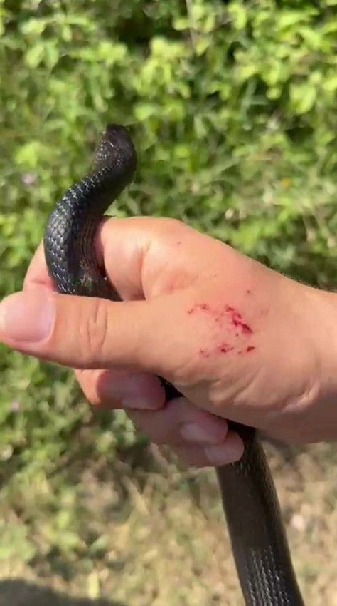 Bir vatandaş eline alıp ''zararsızdır öldürmeyin'' dediği yılan tarafından ısırıldı - Resim: 3