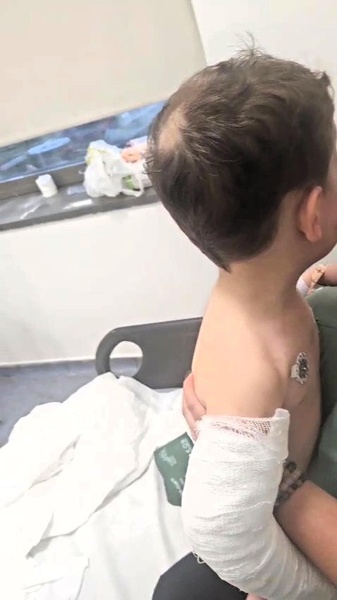 Annesinin sevgilisi dehşeti yaşattı: 2 yaşındaki bebek hastanelik oldu - Resim: 3