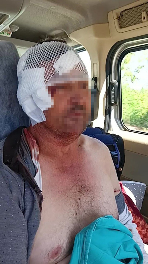 Antalya'da aslan saldırısına uğrayan çiftçi nasıl kurtulduğunu anlattı - Resim: 3