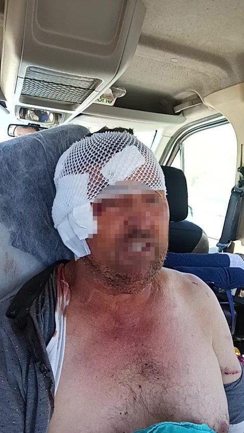 Antalya'da aslan saldırısına uğrayan çiftçi nasıl kurtulduğunu anlattı - Resim: 4