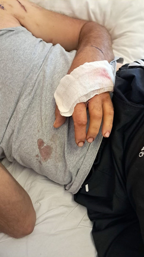 Ayı saldırısından mucize bir şekilde kurtulan çiftçi yaşadığı kabusu anlatı - Resim: 2