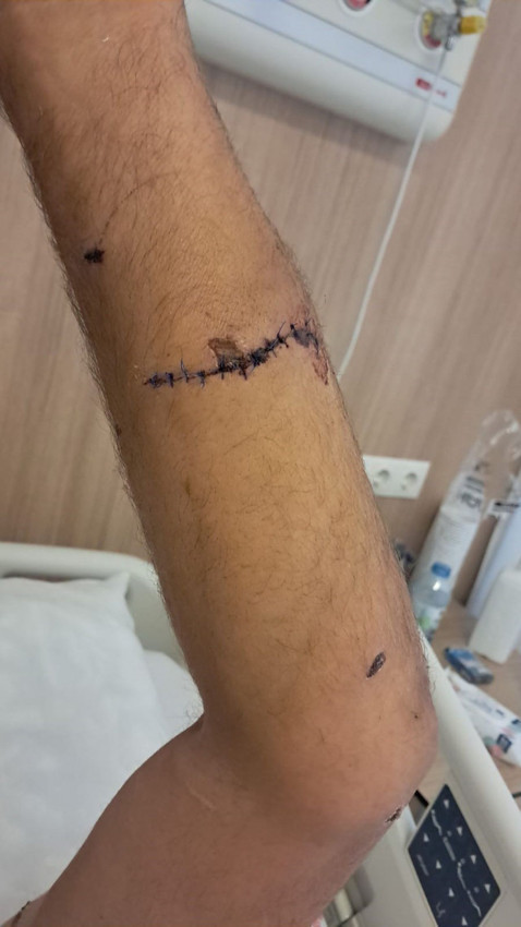 Ayı saldırısından mucize bir şekilde kurtulan çiftçi yaşadığı kabusu anlatı - Resim: 4