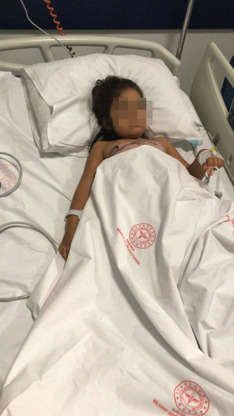 Komşunun pitbullu biri 1,5 diğeri 5 yaşındaki iki çocuğu hastanelik etti - Resim: 4