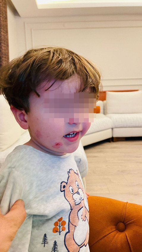 Kreşte skandal: 2,5 yaşındaki çocuk darp edilmiş halde bulundu - Resim: 3