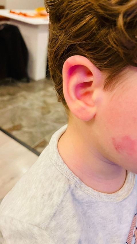 Kreşte skandal: 2,5 yaşındaki çocuk darp edilmiş halde bulundu - Resim: 4