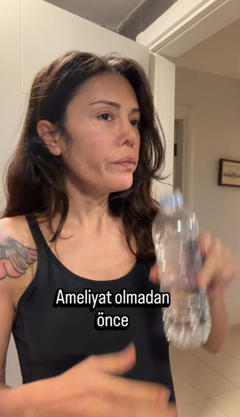 Yüz nakli olan Didem Ceran son halini paylaştı: ''Bebeksiliğim yapay zeka değil'' - Resim: 3