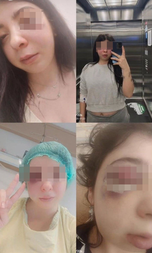 Damla'yı sokak ortasında taciz edip, öldüresiye dövdüler - Resim: 3