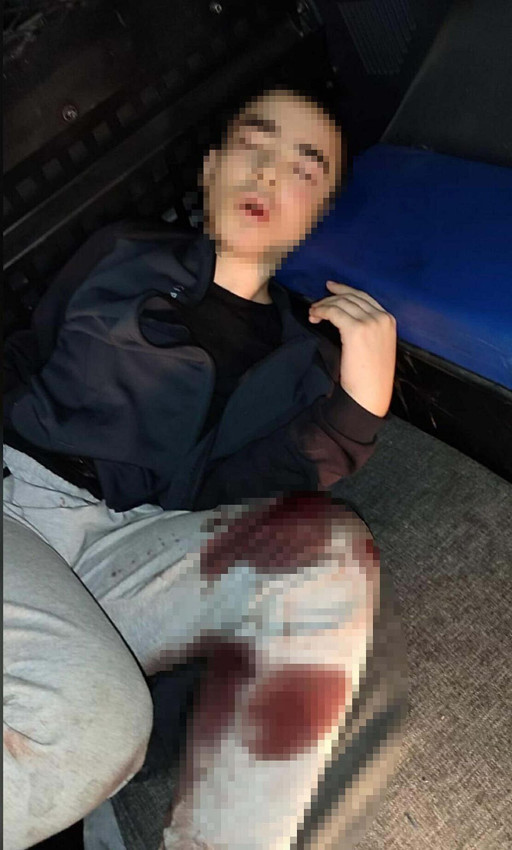 İzmir'deki karakol saldırısından günler sonra acı haber: Şehit sayısı 3'e yükseldi - Resim: 2