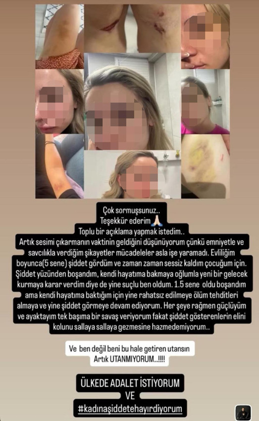 Sosyal medyadan yardım isteyen öğretmenin eski eşine öldüresiye dayak! - Resim: 2