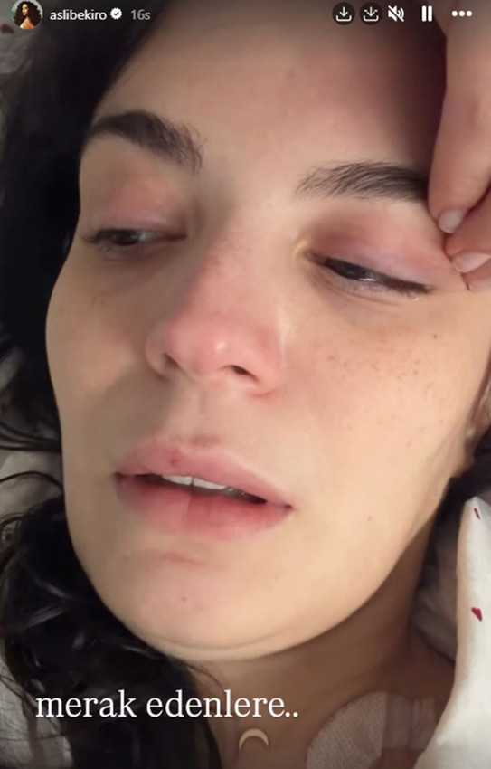 Doktor hatası yüzünden hayatı kabusa dönen güzel oyuncu hastaneden çıkamıyor... Ağlayarak paylaştı! - Resim: 4