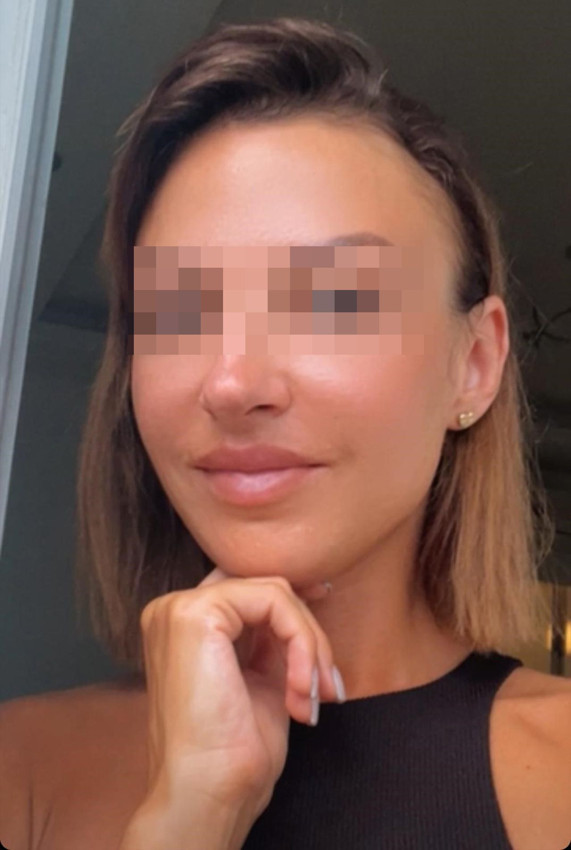 Bir uzaklaştırma kararlı eski eş dehşeti daha: Ukraynalı genç kadına kabusu yaşattı - Resim: 2