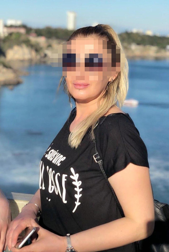 Bir estetik faciası daha: 3 çocuk annesi kadın dudağını kaybetti - Resim: 2