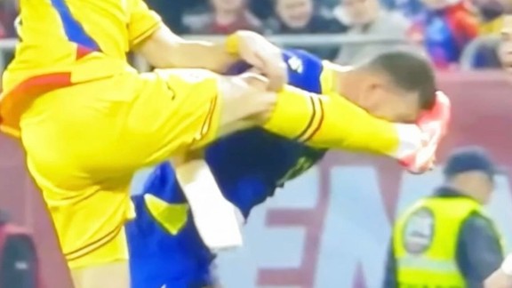 Fenerbahçe'ye kötü haber: Dzeko'nun burnu kırıldı