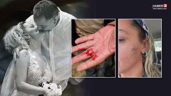 Yıldız Asyalı'dan eşi hakkında şoke eden iddialar: ''Önce beni ardından da babamı darbetti!''