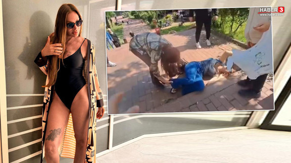 Sevda Demirel'den korkutan haber! Maçka Parkı'nda yürüyüş yaparken ayağını kırdı