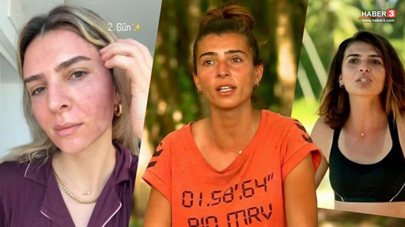 Survivor'ın iddialı yarışmacısının değişimi olay oldu; Son halini görenler şaşkınlık yaşadı