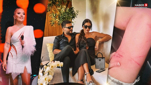 Demet Akalın'dan Dilan Polat ve Engin Polat ile ilgili skandal iddialar!