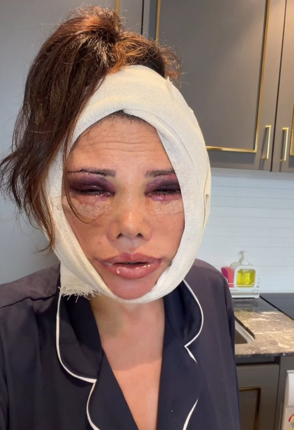 Yüz değiştirme ameliyatı olan eski Survivor yarışmacısından şoke eden iddialar - Resim: 4