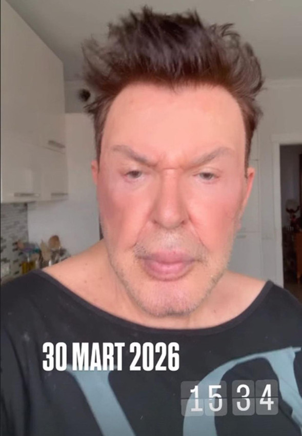 Ünlü şarkıcı estetik eleştirilerine isyan etti: ''Utanmasalar küfür edecekler!'' - Resim: 2